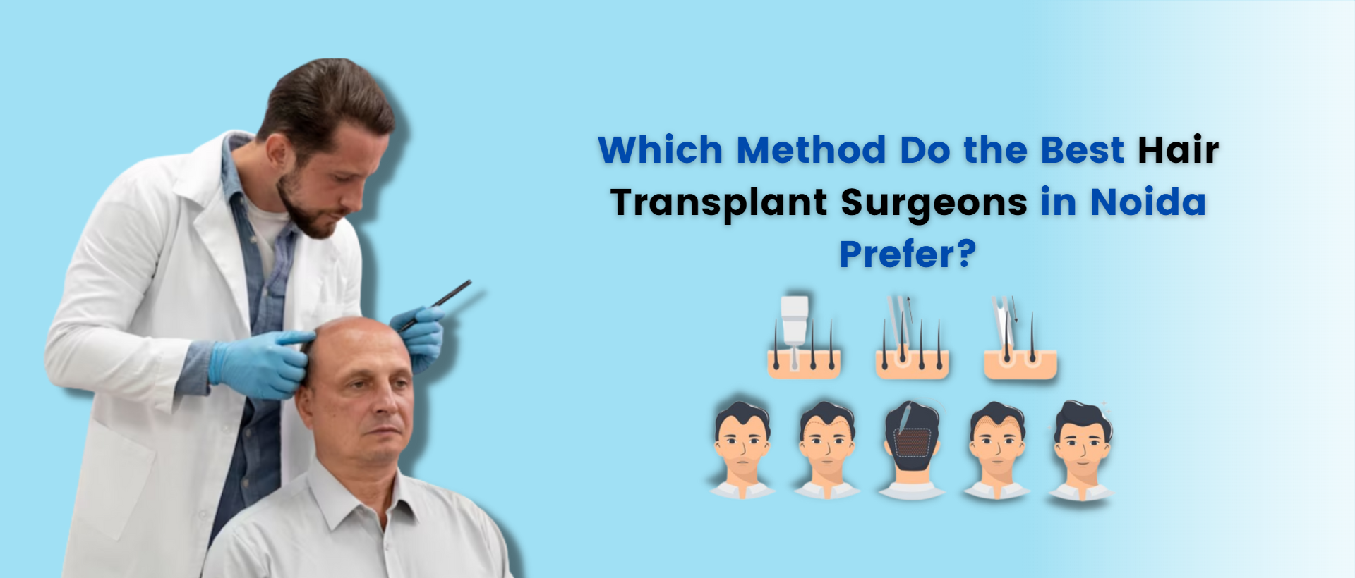 Which method do the best hair transplant surgeons in noida prefer?